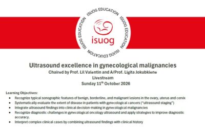 Ultrasound excellence in gynecological malignancies